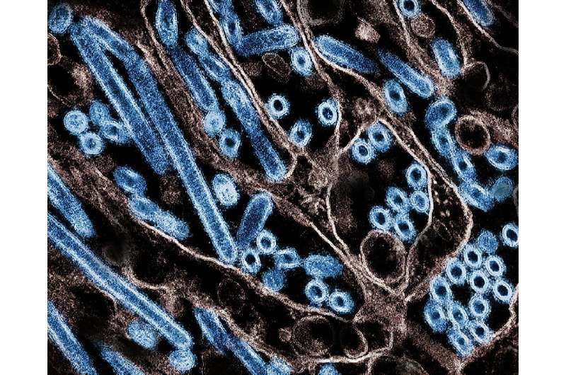 A colorized transmission electron micrograph of avian influenza A H5N1 virus particles (blue), grown in Madin-Darby Canine Kidney (MDCK) epithelial cells